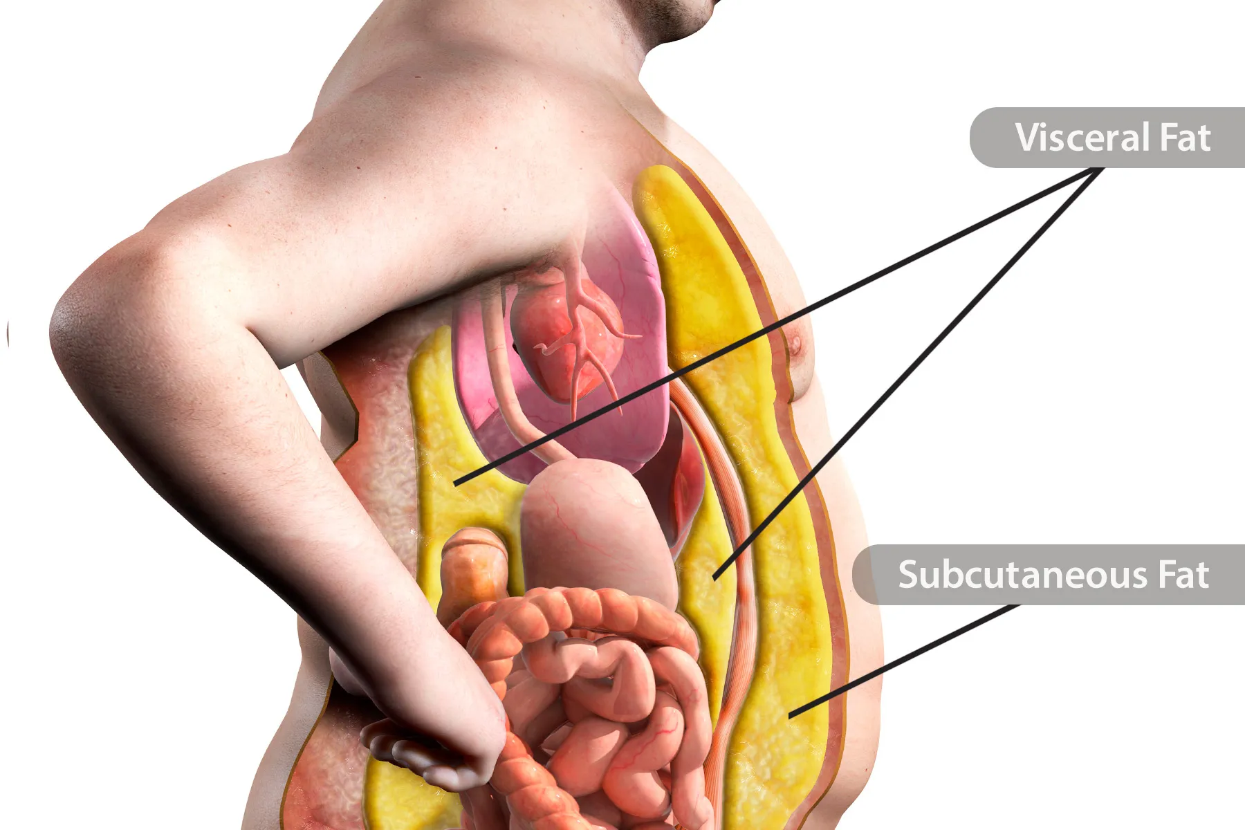 Visceral Fat Health Risks